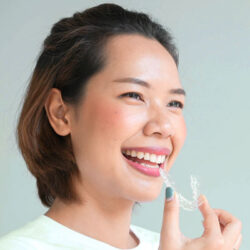 Durchsichtige Zahnspange (Invisalign)