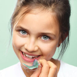 KFO Frühbehandlung Kinder