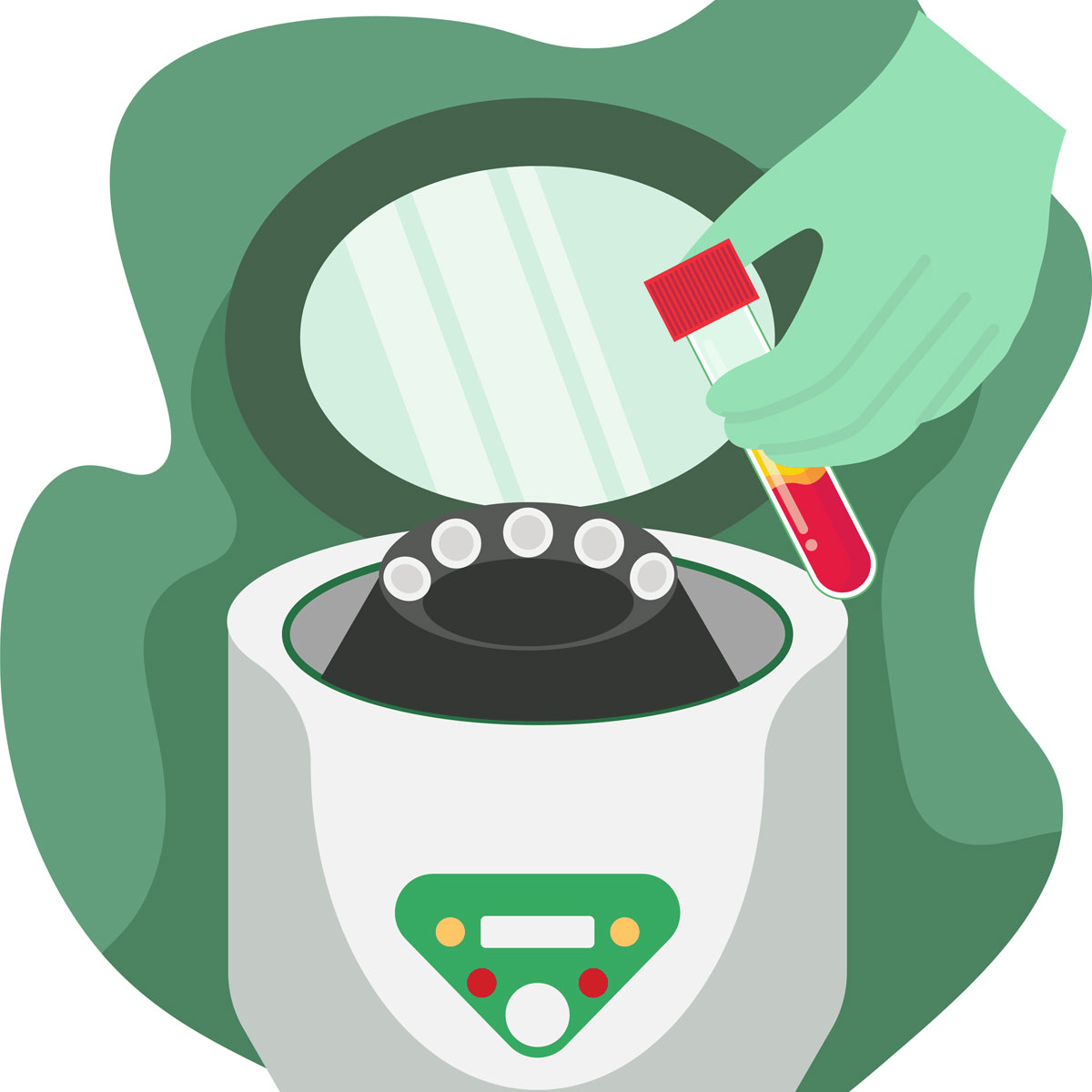 Eigenbluttherapie (PRF)